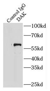 TKFC Antibody