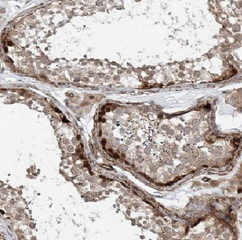 DAND5 Antibody