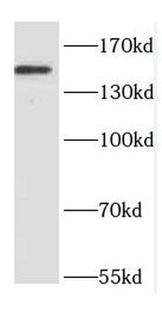 DAPK1 Rabbit Polyclonal Antibody