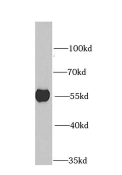 DARS1 Antibody