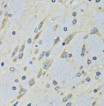 DARS1 Antibody