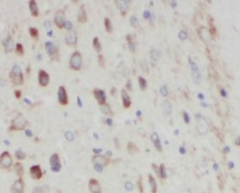 SLC6A3 Antibody