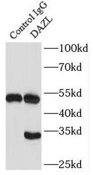 DAZL Antibody