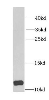 DBI Rabbit Polyclonal Antibody