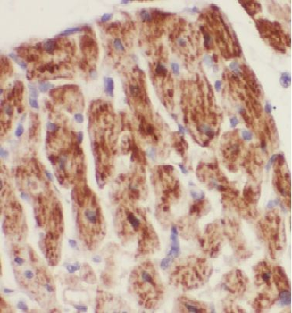 DBI Rabbit Polyclonal Antibody