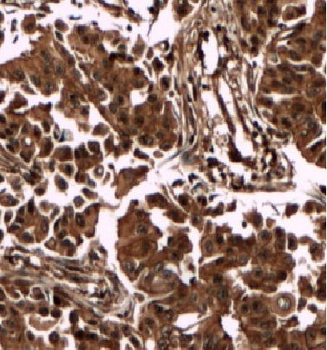 DBNL Antibody