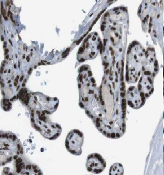 DBR1 Antibody