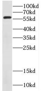 DCLRE1B Antibody