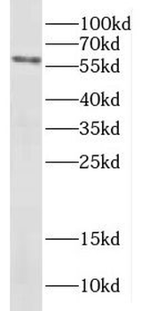 DCLRE1C Antibody