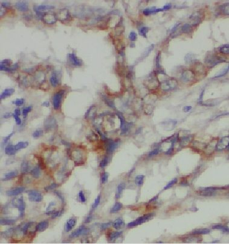 DCP1A Antibody