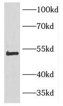 TNFRSF10D Antibody