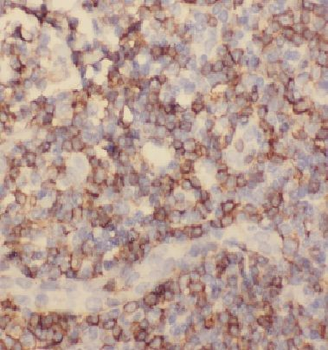TNFRSF10D Antibody