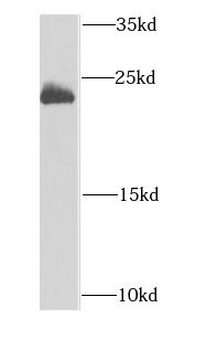 DCTD Antibody
