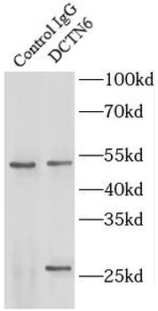 DCTN6 Antibody