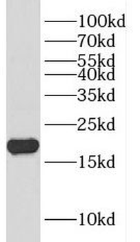 DCTPP1 Rabbit Polyclonal Antibody