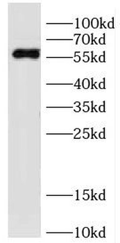 DDB2 Rabbit Polyclonal Antibody
