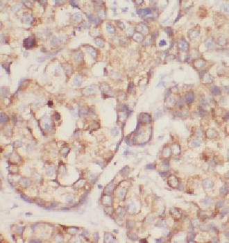 DDRGK1 Antibody