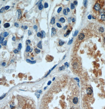 DDX10 Antibody