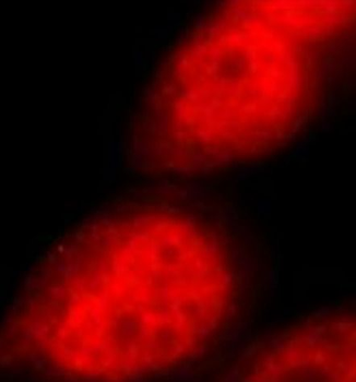 DDX17 Antibody