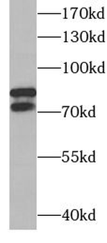 DDX17 Antibody