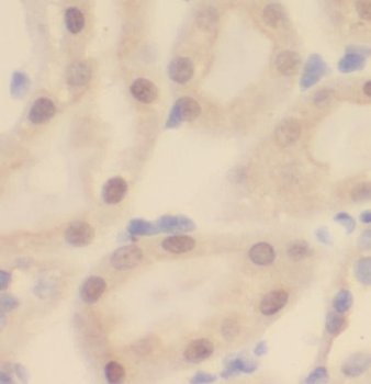 DDX17 Antibody