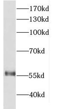 DDX19B Rabbit Polyclonal Antibody