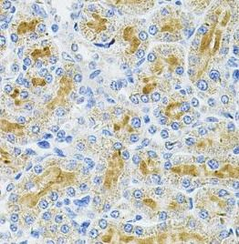 DDX20 Antibody