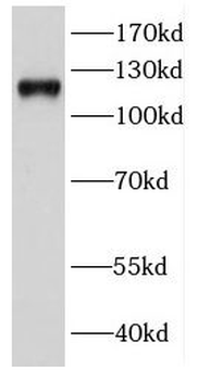 DDX24 Antibody