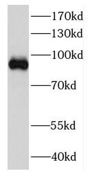 DDX27 Antibody