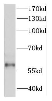DDX28 Antibody