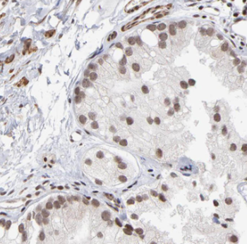 DDX28 Antibody