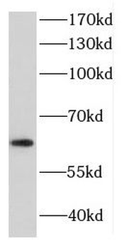DDX3X Rabbit Polyclonal Antibody