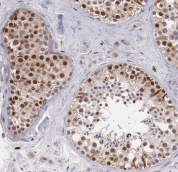 DDX39A Antibody