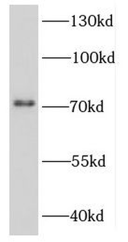 DDX3Y Antibody
