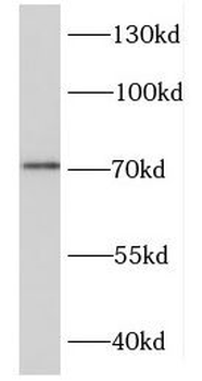DDX43 Rabbit Polyclonal Antibody