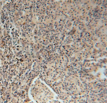 DDX43 Rabbit Polyclonal Antibody