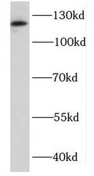DDX46 Antibody