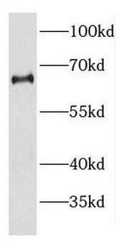 DDX56 Antibody