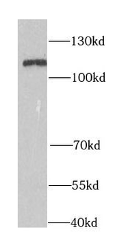 RIGI Rabbit Polyclonal Antibody