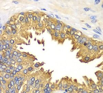 RIGI Rabbit Polyclonal Antibody