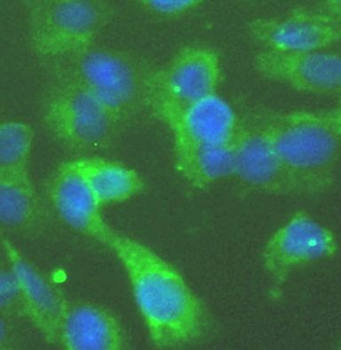 RIGI Rabbit Polyclonal Antibody