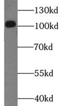 RIGI Rabbit Polyclonal Antibody