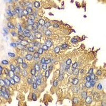RIGI Rabbit Polyclonal Antibody