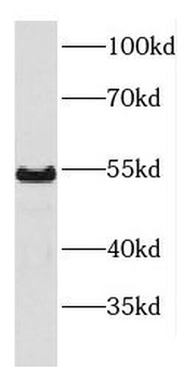 DDX6 Antibody