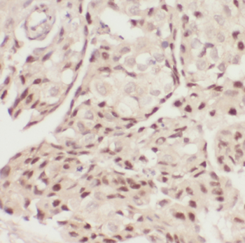 DDX6 Antibody