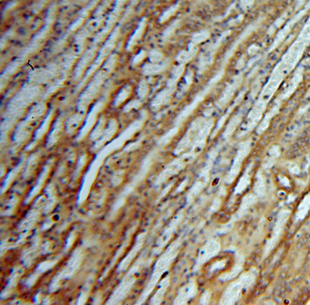 DEAF1 Antibody