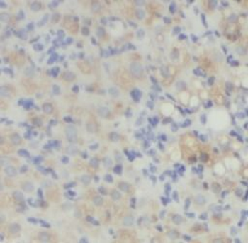 DCN Antibody