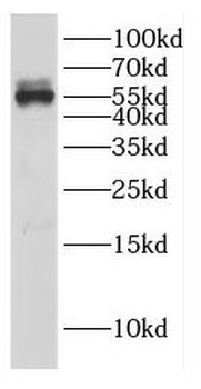DEPTOR Antibody