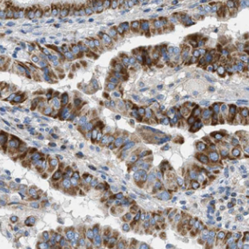 DEPTOR Antibody