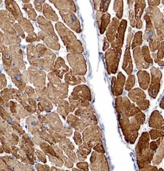 DES Antibody